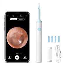 Wireless Ear Cleaner with 1080P HD Camera &amp; 6 LED Lights – Smart Ear Wax Removal Otoscope