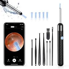 Wireless Ear Cleaner with 1080P HD Camera &amp; 6 LED Lights – Smart Ear Wax Removal Otoscope